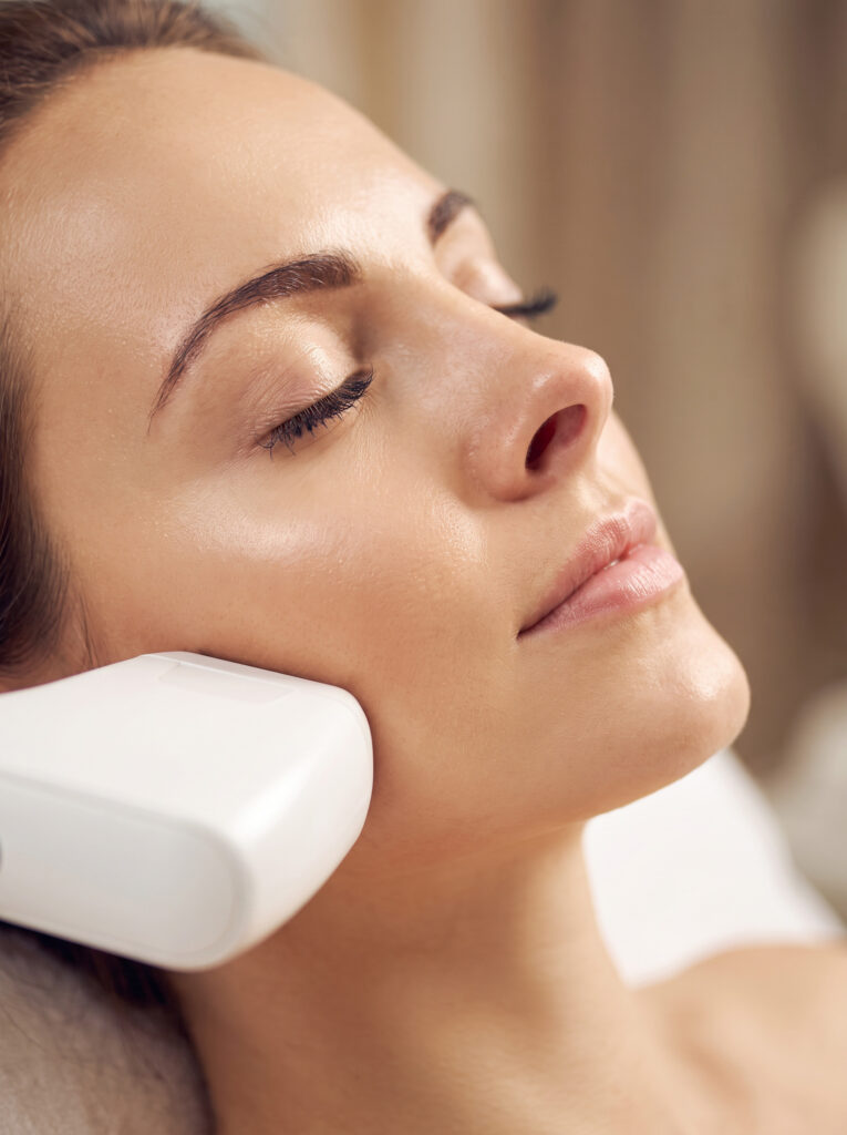 Sofwave Treatment 1